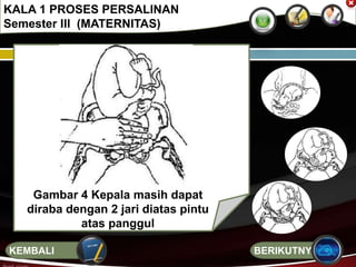 KALA 1 PROSES PERSALINAN
Semester III (MATERNITAS)
Gambar 4 Kepala masih dapat
diraba dengan 2 jari diatas pintu
atas panggul
BERIKUTNYAKEMBALI
 