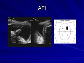 Maternity and Pediatric Nursing | PPT