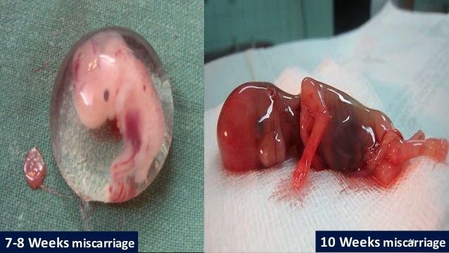 What Does The Dogs Placenta Look Like What Does The Dogs Placenta Look Like