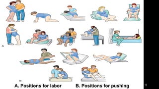 18
A. Positions for labor B. Positions for pushing
 