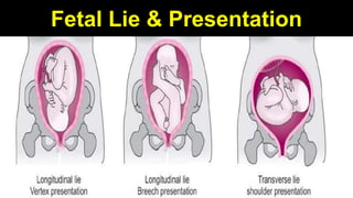 9
Fetal Lie & Presentation
 