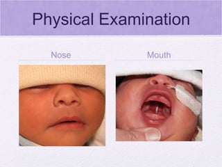 Physical Examination Nose  Mouth 