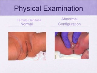 Physical Examination Normal  Abnormal Configuration Female Genitalia 