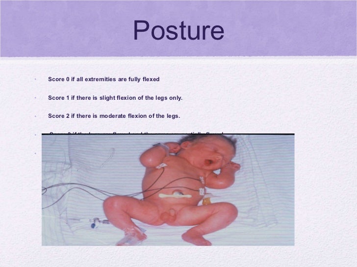 Newborn Health Assessment