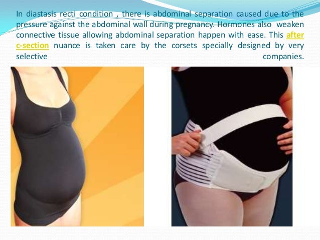 Maternity Support Belt