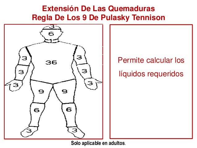Materno infantil ii quemaduras (2)