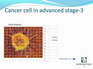 Mathematical modeling in the diagnosis of cancer | PPT