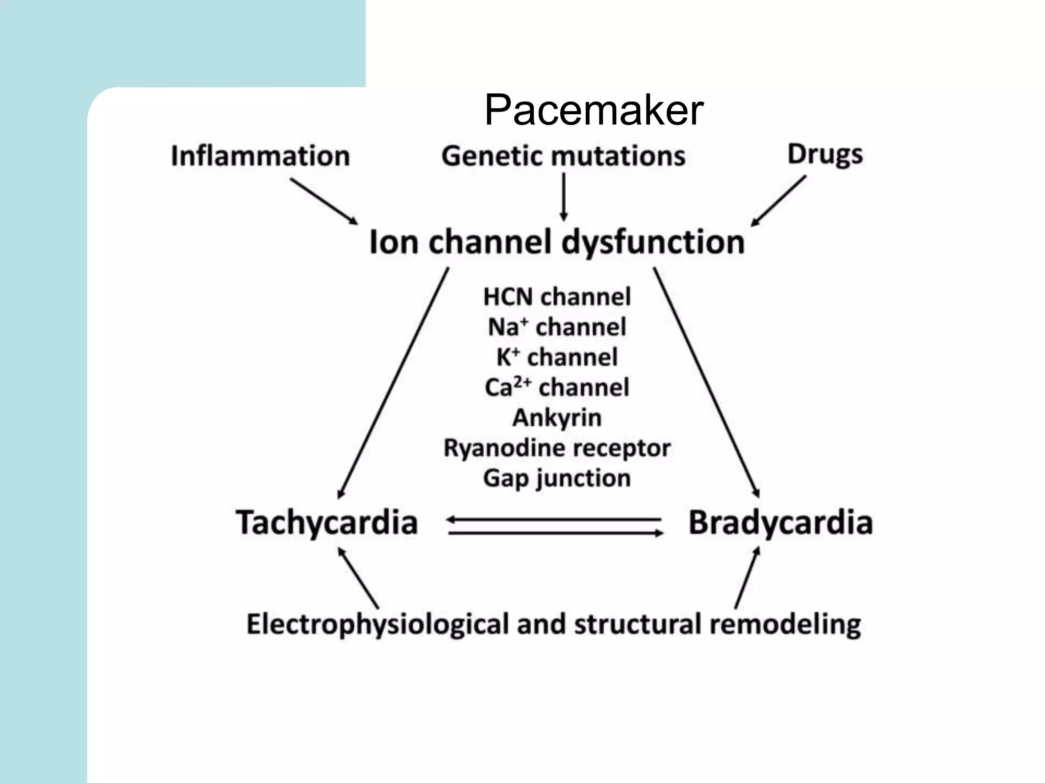 Pacemaker
 