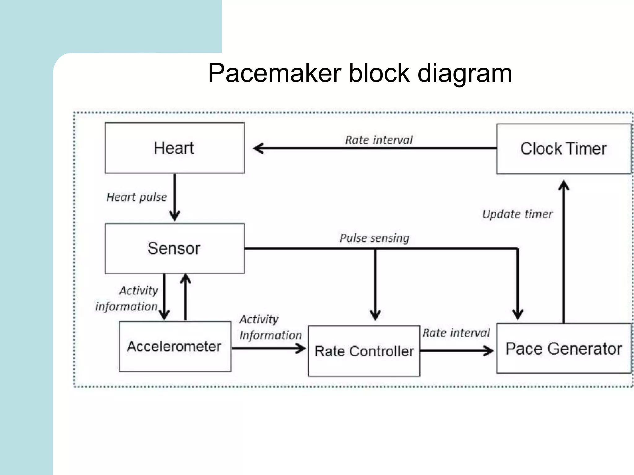 Pacemaker block diagram
 