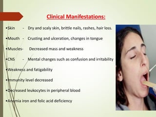 Clinical Manifestations:
•Skin - Dry and scaly skin, brittle nails, rashes, hair loss.
•Mouth - Crusting and ulceration, changes in tongue
•Muscles- Decreased mass and weakness
•CNS - Mental changes such as confusion and irritability
•Weakness and fatigability
•Immunity level decreased
•Decreased leukocytes in peripheral blood
•Anemia iron and folic acid deficiency
 