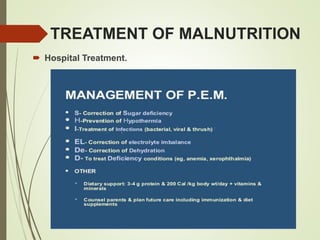 TREATMENT OF MALNUTRITION
 Hospital Treatment.
 