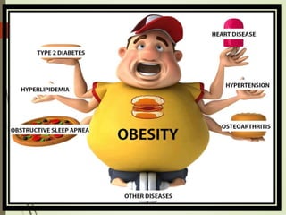 OBESITY
 