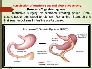 Combination of restrictive and mal absorptive surgery:
Roux-en- Y gastric bypass :
Restrictive surgery on stomach creating pouch. Small
gastric pouch connected to jejunum. Remaining Stomach and
first segment of small intestine are bypassed.
 