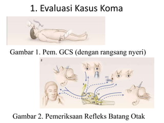 Gambar 1. Pem. GCS (dengan rangsang nyeri)
Gambar 2. Pemeriksaan Refleks Batang Otak
1. Evaluasi Kasus Koma
 