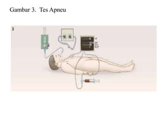 Gambar 3. Tes Apneu
 