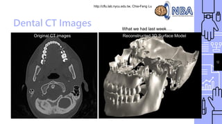 http://cflu.lab.nycu.edu.tw, Chia-Feng Lu
Dental CT Images
Original CT images Reconstructed 3D Surface Model
12
What we had last week….
 