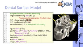 http://cflu.lab.nycu.edu.tw, Chia-Feng Lu
Dental Surface Model
13
Please select an appropriate threshold value.
 