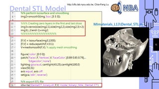 http://cflu.lab.nycu.edu.tw, Chia-Feng Lu
Dental STL Model
15
MImaterials_L13Dental_STL.m
 