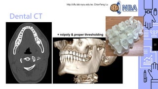 http://cflu.lab.nycu.edu.tw, Chia-Feng Lu
23
Dental CT
+ roipoly & proper thresholding
 