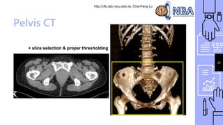 http://cflu.lab.nycu.edu.tw, Chia-Feng Lu
28
Pelvis CT
+ slice selection & proper thresholding
 