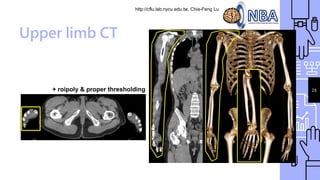 http://cflu.lab.nycu.edu.tw, Chia-Feng Lu
29
Upper limb CT
+ roipoly & proper thresholding
 
