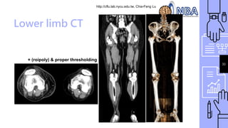 http://cflu.lab.nycu.edu.tw, Chia-Feng Lu
30
Lower limb CT
+ (roipoly) & proper thresholding
 