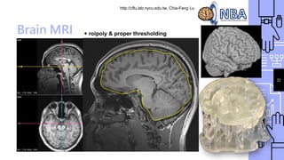 http://cflu.lab.nycu.edu.tw, Chia-Feng Lu
32
Brain MRI + roipoly & proper thresholding
 