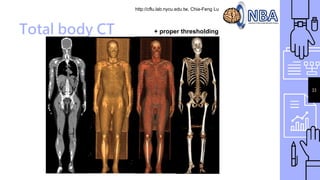 http://cflu.lab.nycu.edu.tw, Chia-Feng Lu
33
Total body CT + proper thresholding
 