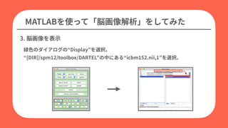 Display
[DIR]/spm12/toolbox/DARTEL icbm152.nii,1
MATLAB
3.
 