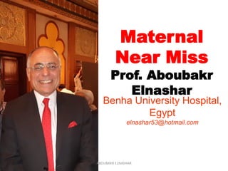 Maternal
Near Miss
Prof. Aboubakr
Elnashar
Benha University Hospital,
Egypt
elnashar53@hotmail.com
ABOUBAKR ELNASHAR
 