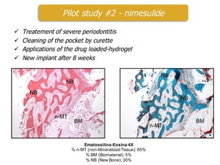 ü Treatement of severe periodontitis
ü Cleaning of the pocket by curette
ü Applications of the drug loaded-hydrogel
ü New implant after 8 weeks
Pilot study #2 - nimesulide
NB
BM
n-MT
NB
NB
n-MT
BM
NB
Ematossilina-Eosina 4X
% n-MT (non-Mineralized Tissue): 65%
% BM (Biomaterial): 5%
% NB (New Bone): 30%
 