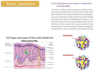 Levofloxacin
Gentamicin
Topical applications
 