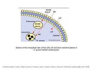 Scheme of the intracellular fate of free GM, LVF and their nanoformulations in
S. aureus-infected keratinocytes.
E. Montanari, A.Oates, C. Di Meo, J. Meade, R. Cerrone, A. Francioso, S. Devine, T. Coviello, P. Mancini, L. Mosca and P. Matricardi Adv. Healthcare Mater. 2018, 1701483
 