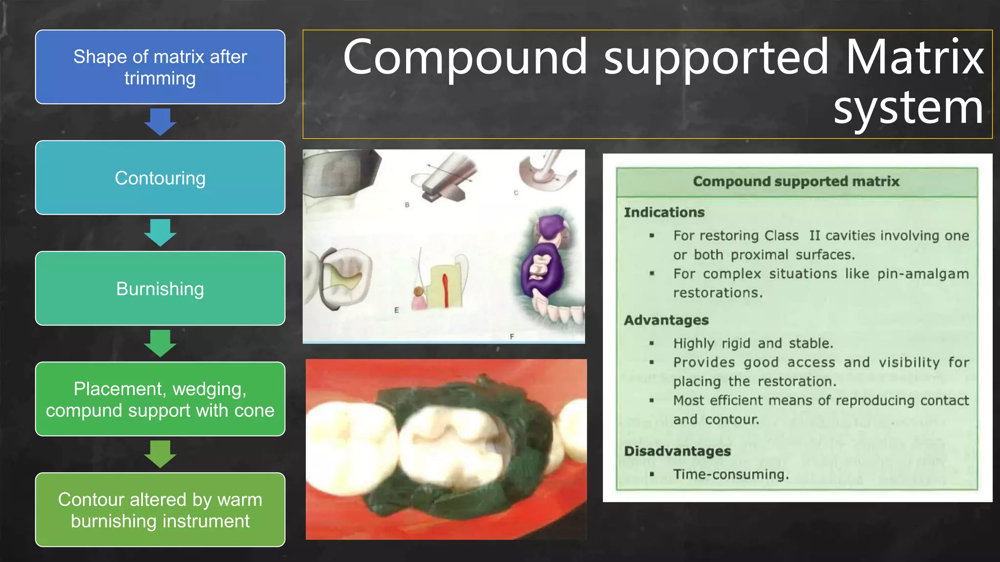 Compound supported Matrix
system
Shape of matrix after
trimming
Contouring
Burnishing
Placement, wedging,
compund support with cone
Contour altered by warm
burnishing instrument
 