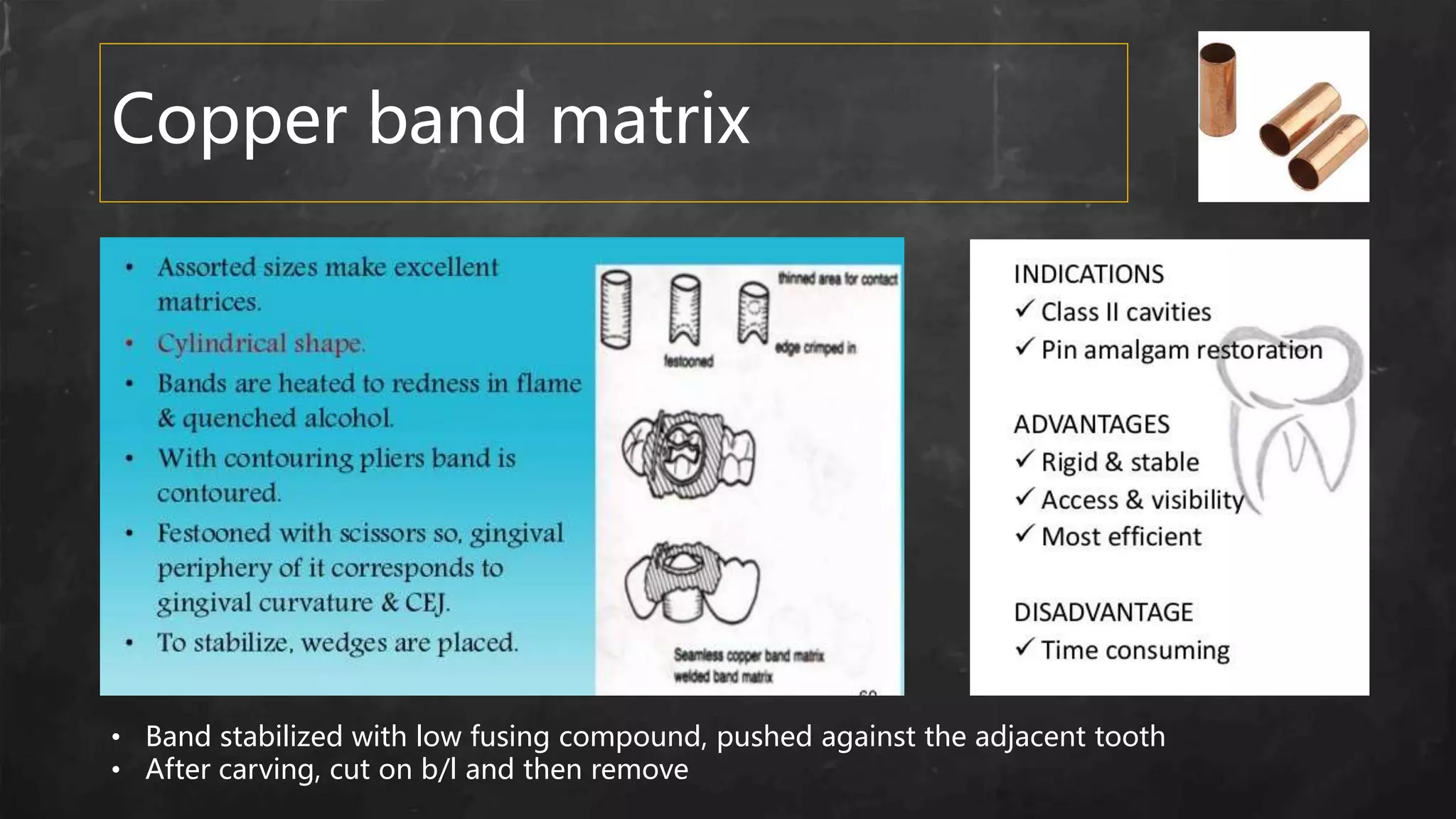 Copper band matrix
• Band stabilized with low fusing compound, pushed against the adjacent tooth
• After carving, cut on b/l and then remove
 