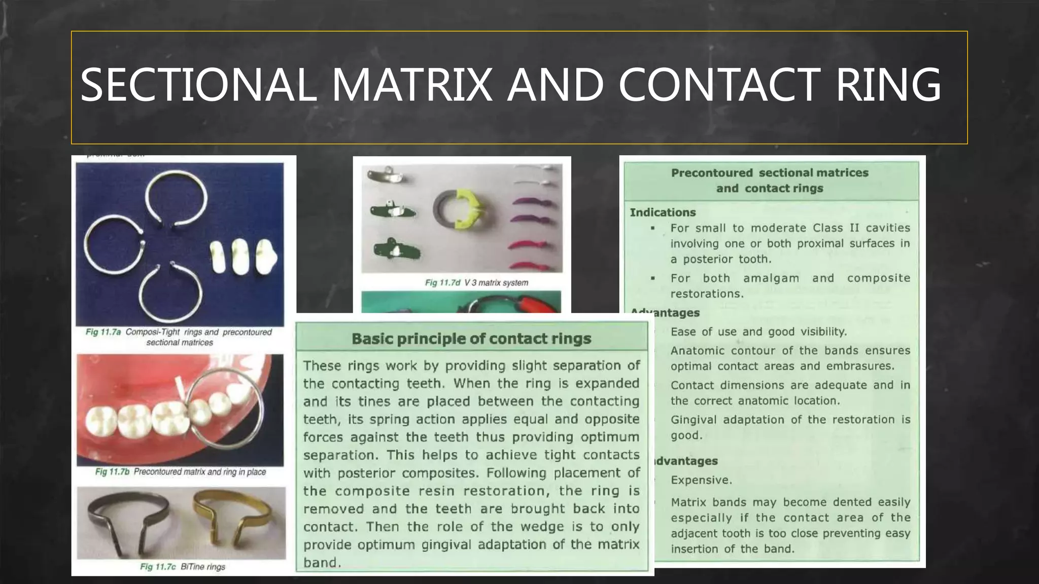 SECTIONAL MATRIX AND CONTACT RING
• KHB
 