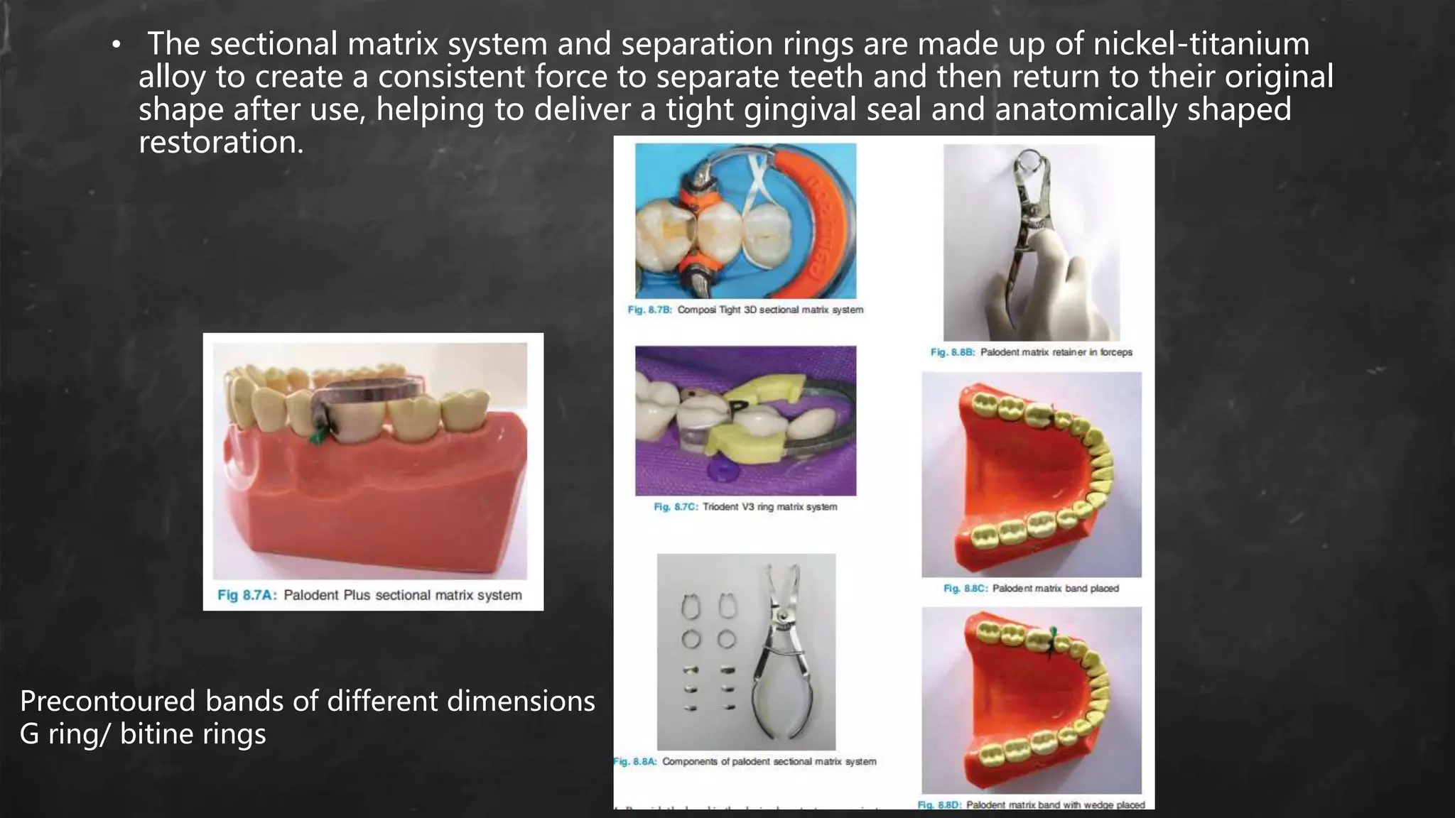 • The sectional matrix system and separation rings are made up of nickel-titanium
alloy to create a consistent force to separate teeth and then return to their original
shape after use, helping to deliver a tight gingival seal and anatomically shaped
restoration.
Precontoured bands of different dimensions
G ring/ bitine rings
 