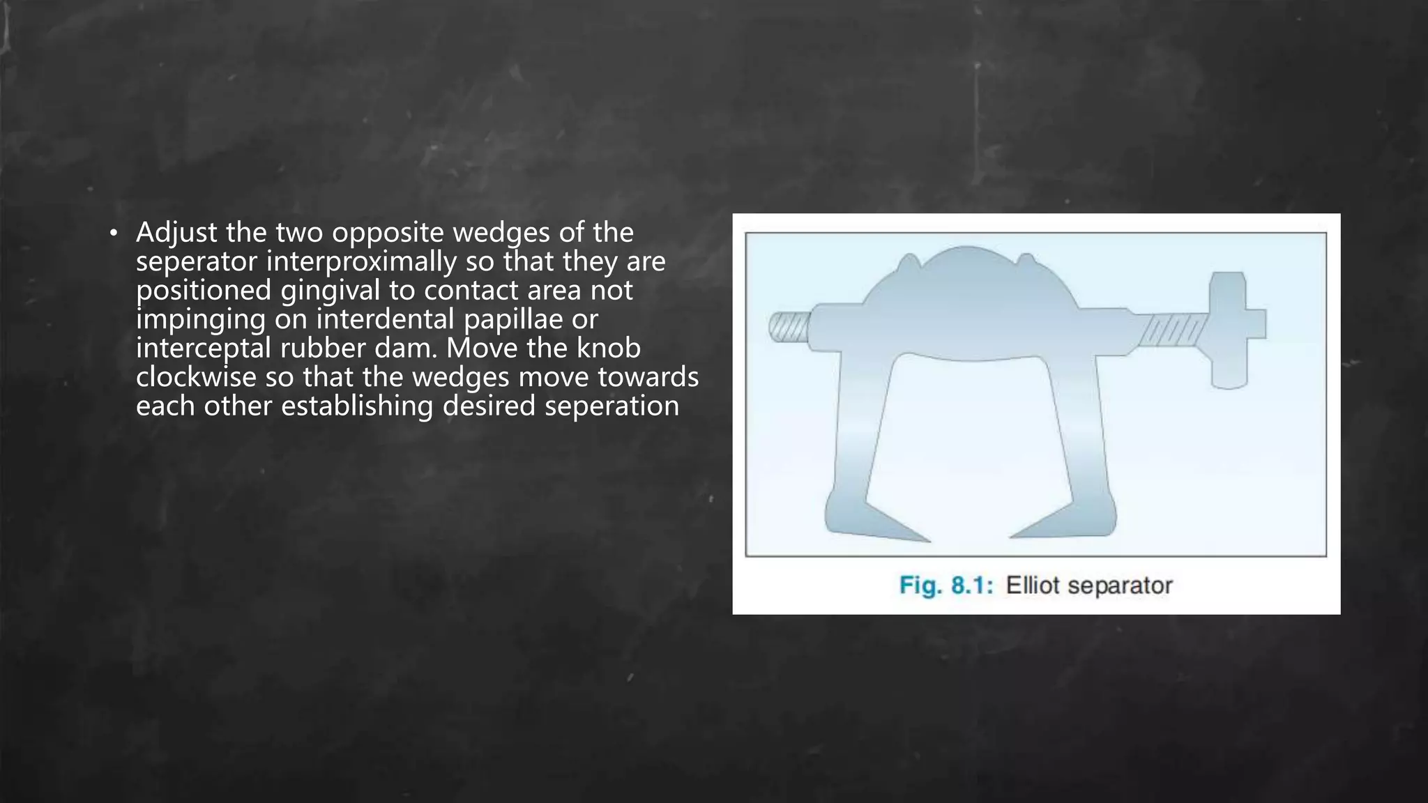 • Adjust the two opposite wedges of the
seperator interproximally so that they are
positioned gingival to contact area not
impinging on interdental papillae or
interceptal rubber dam. Move the knob
clockwise so that the wedges move towards
each other establishing desired seperation
 