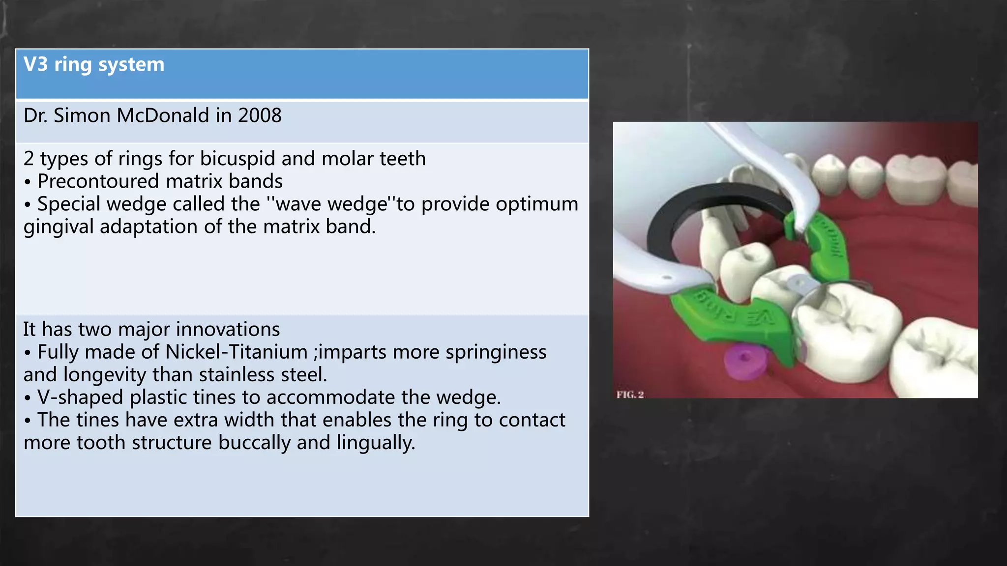V3 ring system
Dr. Simon McDonald in 2008
2 types of rings for bicuspid and molar teeth
• Precontoured matrix bands
• Special wedge called the ''wave wedge''to provide optimum
gingival adaptation of the matrix band.
It has two major innovations
• Fully made of Nickel-Titanium ;imparts more springiness
and longevity than stainless steel.
• V-shaped plastic tines to accommodate the wedge.
• The tines have extra width that enables the ring to contact
more tooth structure buccally and lingually.
 