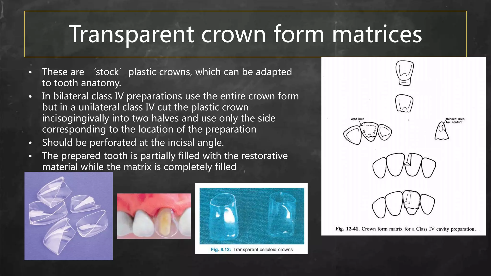 Transparent crown form matrices
• These are ‘stock’plastic crowns, which can be adapted
to tooth anatomy.
• In bilateral class IV preparations use the entire crown form
but in a unilateral class IV cut the plastic crown
incisogingivally into two halves and use only the side
corresponding to the location of the preparation
• Should be perforated at the incisal angle.
• The prepared tooth is partially filled with the restorative
material while the matrix is completely filled
• filled
 