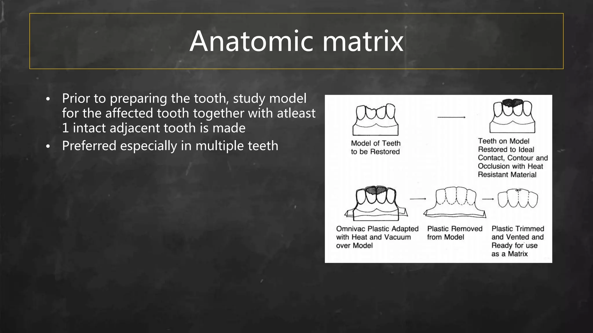Anatomic matrix
• Prior to preparing the tooth, study model
for the affected tooth together with atleast
1 intact adjacent tooth is made
• Preferred especially in multiple teeth
 