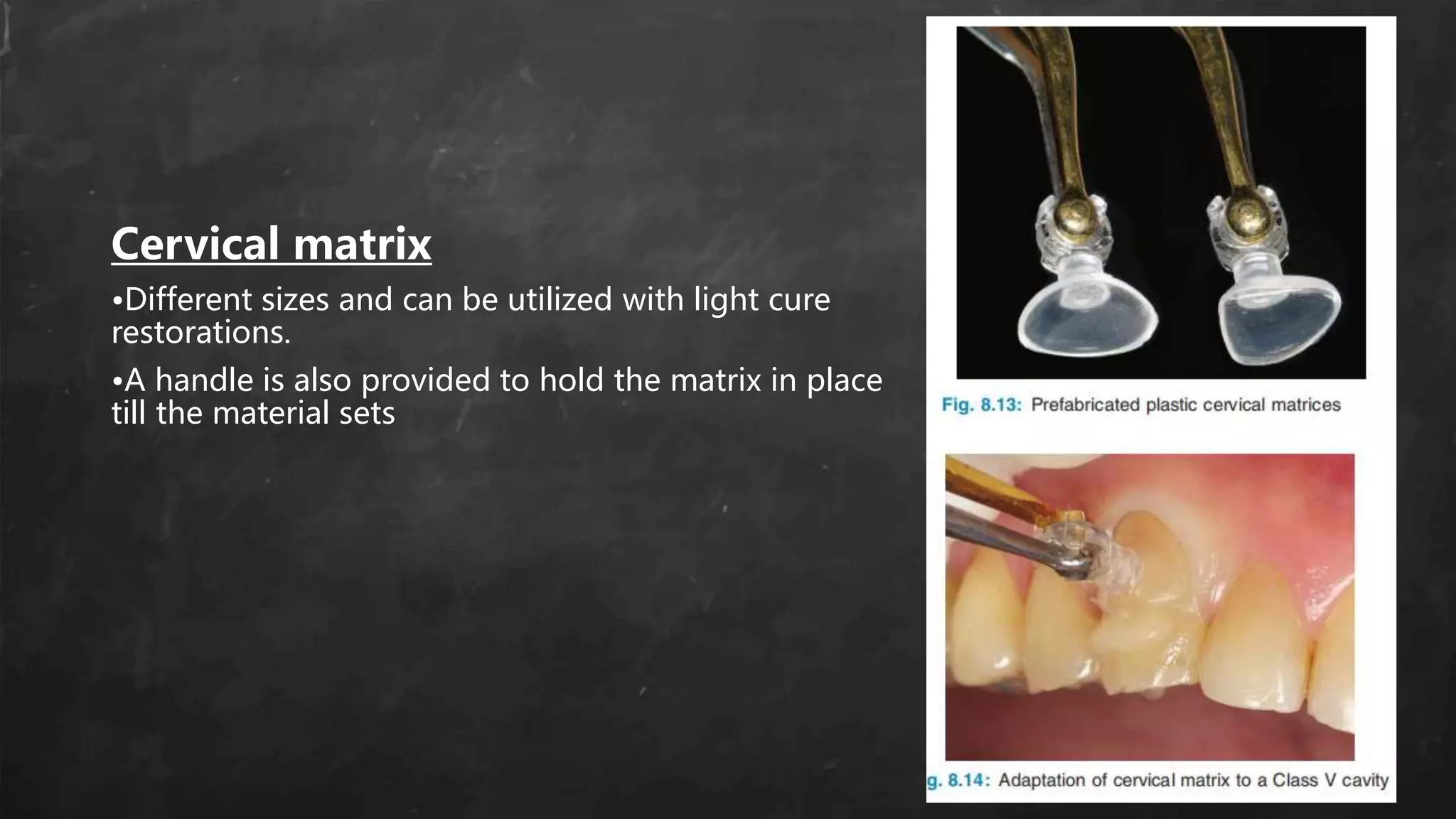 Cervical matrix
•Different sizes and can be utilized with light cure
restorations.
•A handle is also provided to hold the matrix in place
till the material sets
 