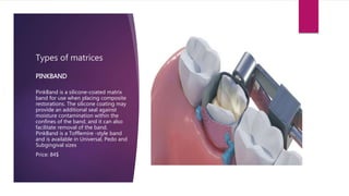 Types of matrices
PinkBand is a silicone-coated matrix
band for use when placing composite
restorations. The silicone coat...