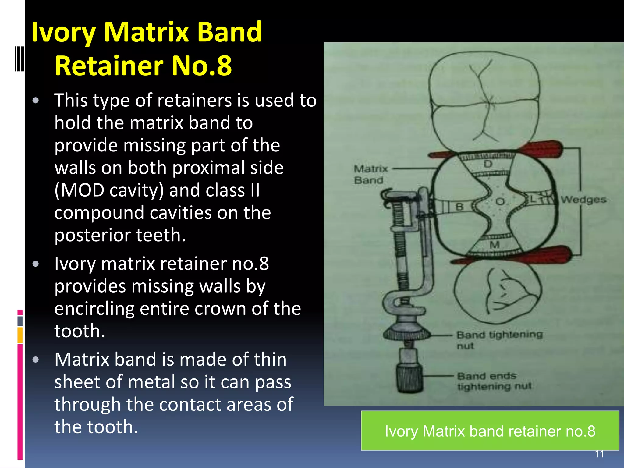 Ivory Matrix Band
Retainer No.8
• This type of retainers is used to
hold the matrix band to
provide missing part of the
walls on both proximal side
(MOD cavity) and class II
compound cavities on the
posterior teeth.
• Ivory matrix retainer no.8
provides missing walls by
encircling entire crown of the
tooth.
• Matrix band is made of thin
sheet of metal so it can pass
through the contact areas of
the tooth.
11
Ivory Matrix band retainer no.8
 