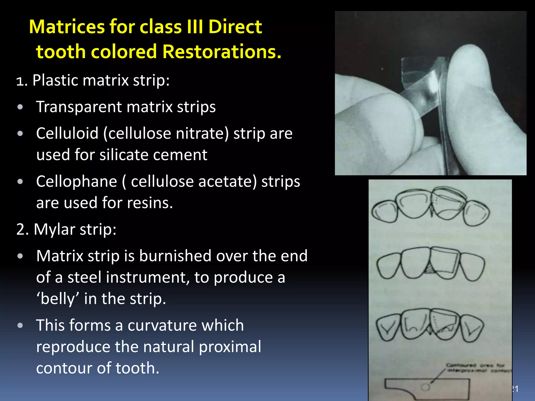 Matrices for class III Direct
tooth colored Restorations.
1. Plastic matrix strip:
• Transparent matrix strips
• Celluloid (cellulose nitrate) strip are
used for silicate cement
• Cellophane ( cellulose acetate) strips
are used for resins.
2. Mylar strip:
• Matrix strip is burnished over the end
of a steel instrument, to produce a
‘belly’ in the strip.
• This forms a curvature which
reproduce the natural proximal
contour of tooth.
21
 
