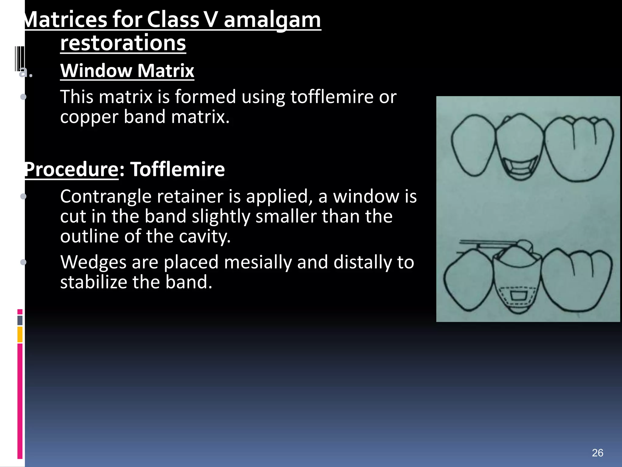 Matrices for ClassV amalgam
restorations
a. Window Matrix
• This matrix is formed using tofflemire or
copper band matrix.
Procedure: Tofflemire
• Contrangle retainer is applied, a window is
cut in the band slightly smaller than the
outline of the cavity.
• Wedges are placed mesially and distally to
stabilize the band.
26
 