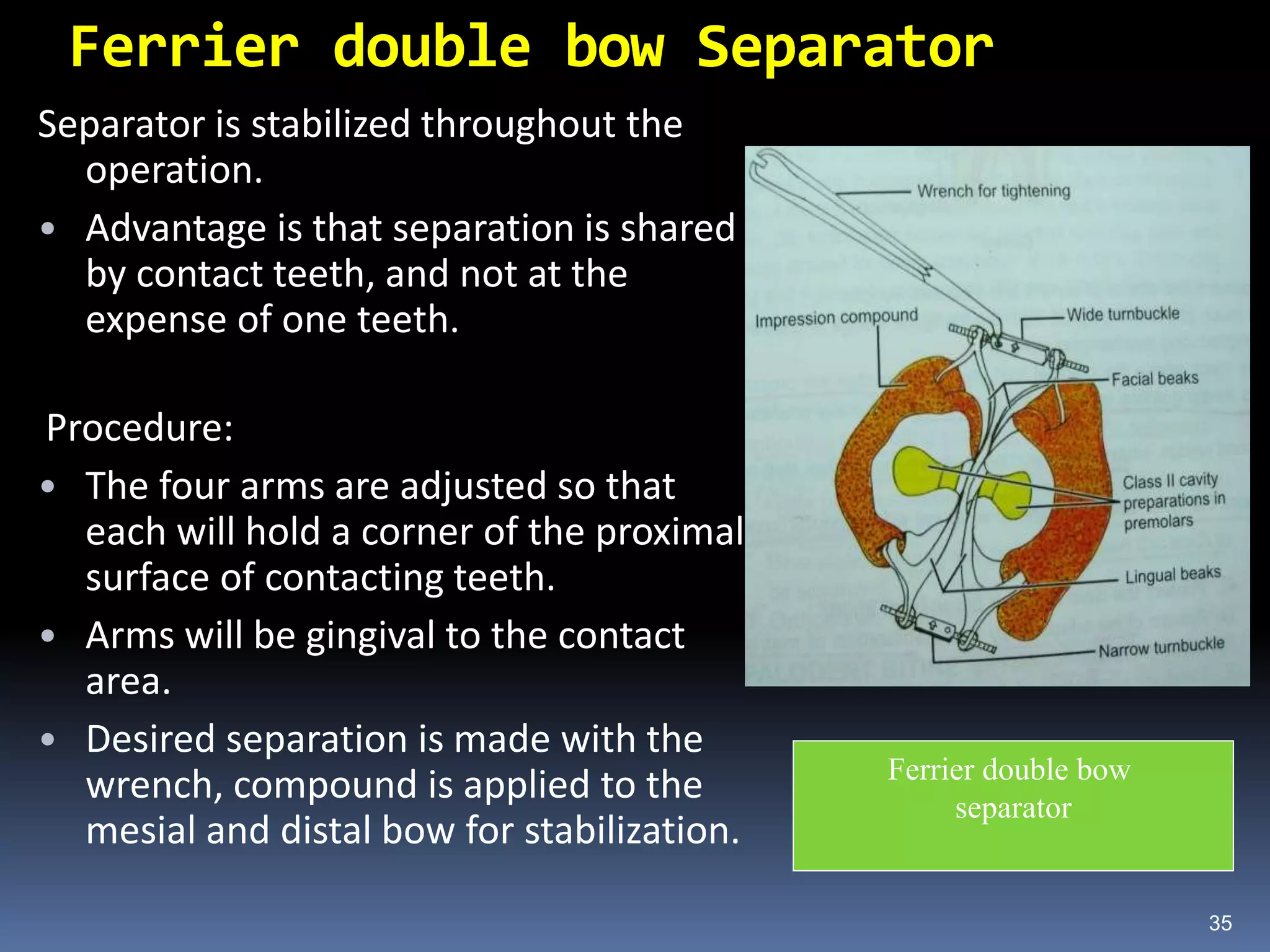 Ferrier double bow Separator
Separator is stabilized throughout the
operation.
• Advantage is that separation is shared
by contact teeth, and not at the
expense of one teeth.
Procedure:
• The four arms are adjusted so that
each will hold a corner of the proximal
surface of contacting teeth.
• Arms will be gingival to the contact
area.
• Desired separation is made with the
wrench, compound is applied to the
mesial and distal bow for stabilization.
35
Ferrier double bow
separator
 
