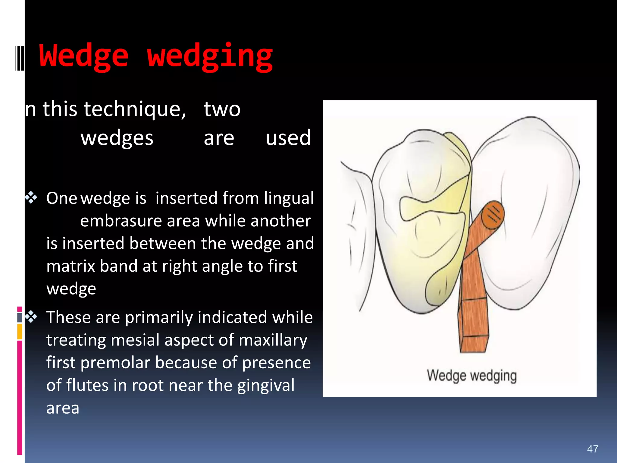 Wedge wedging
In this technique, two
wedges are used
 Onewedge is inserted from lingual
embrasure area while another
is inserted between the wedge and
matrix band at right angle to first
wedge
 These are primarily indicated while
treating mesial aspect of maxillary
first premolar because of presence
of flutes in root near the gingival
area
47
 