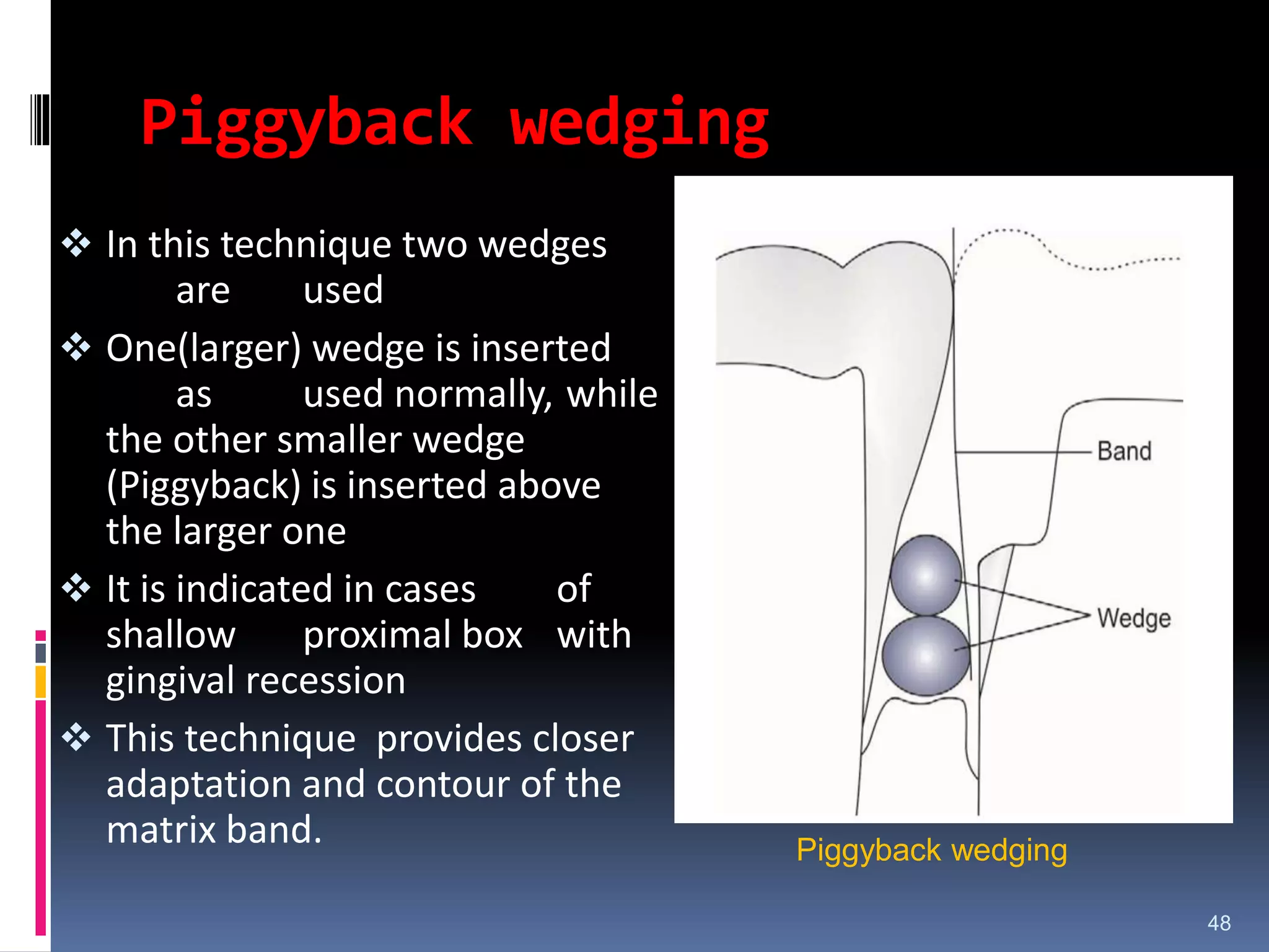 Piggyback wedging
 In this technique two wedges
are used
 One(larger) wedge is inserted
as used normally, while
the other smaller wedge
(Piggyback) is inserted above
the larger one
 It is indicated in cases of
shallow proximal box with
gingival recession
 This technique provides closer
adaptation and contour of the
matrix band.
48
Piggyback wedging
 
