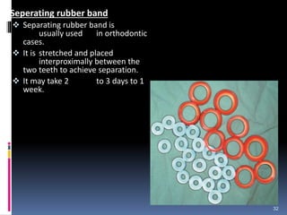 Seperating rubber band
 Separating rubber band is
usually used in orthodontic
cases.
 It is stretched and placed
interproximally between the
two teeth to achieve separation.
 It may take 2 to 3 days to 1
week.
32
 